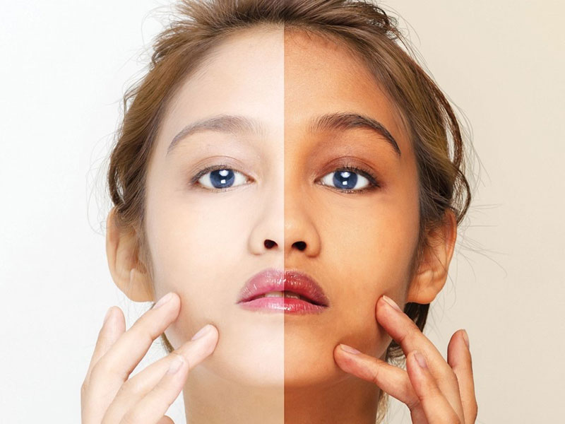 Skin Whitening Revamp Skin Aesthetics