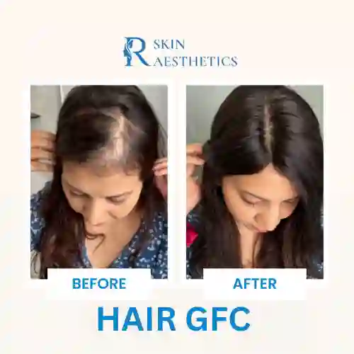 HAIR GFC
